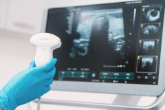 Doctor hand in glove holds ultrasonic probe closeup preparing device for examination, against the background of the ultrasound screen